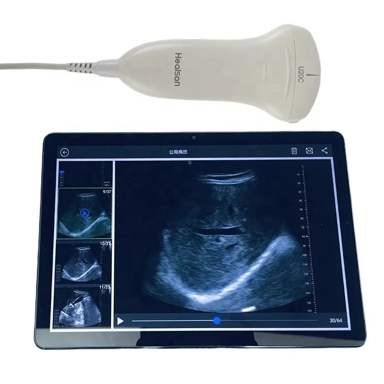 Cheapest Price Handheld Ultrasound Machine Medical Equipment Portable Household Veterinary Digital Ultrasound