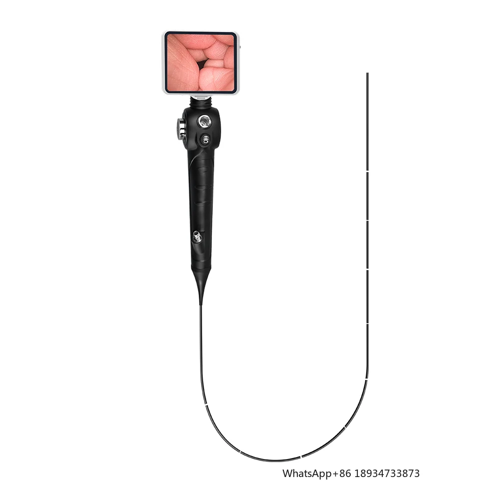 Laryngoscope ENT Endoscopy System Camera Endoscope with Flexible Ent Endoscope