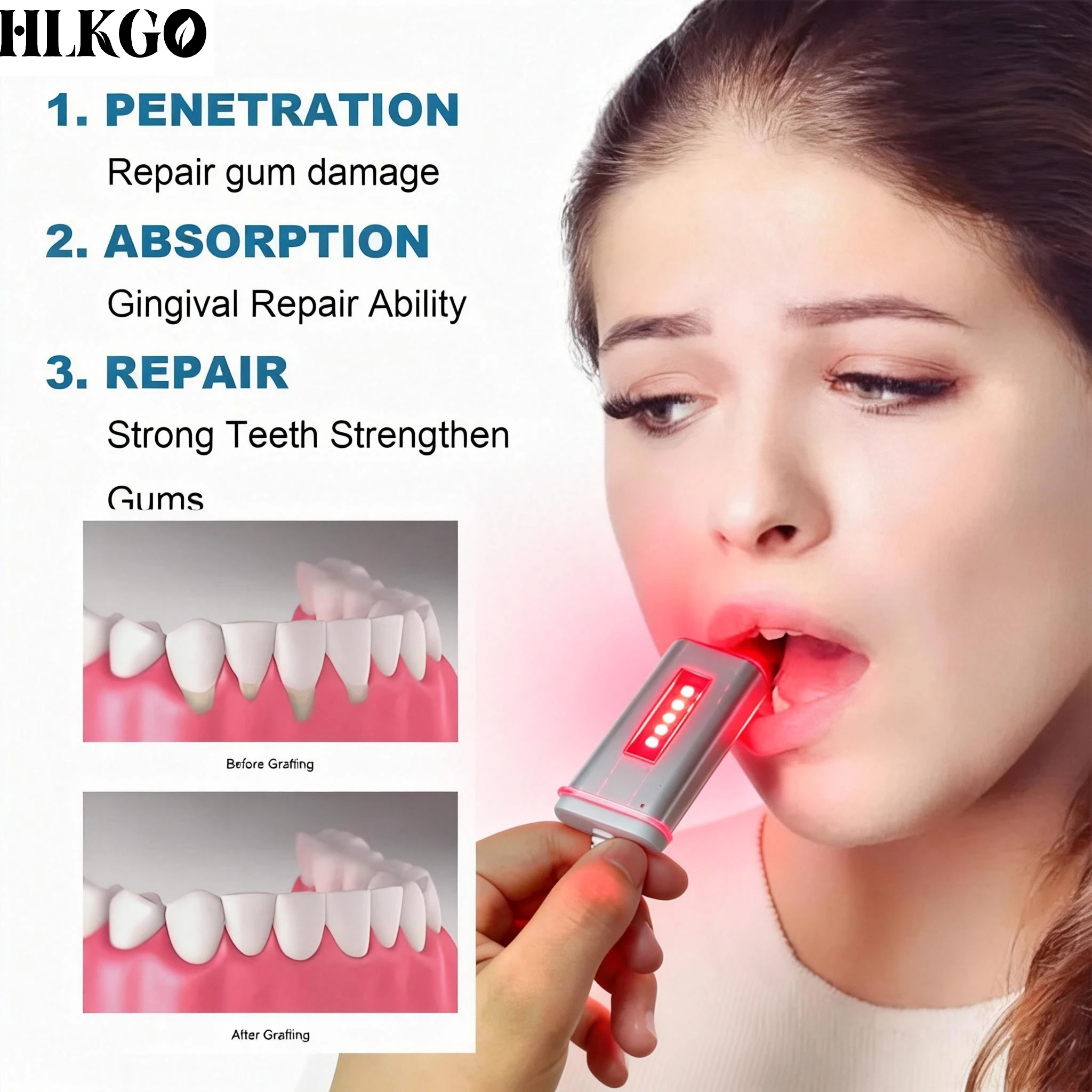 

Портативное устройство для снятия чувствительности десен с помощью красной светотерапии - облегчение воспалений и уход за полостью рта