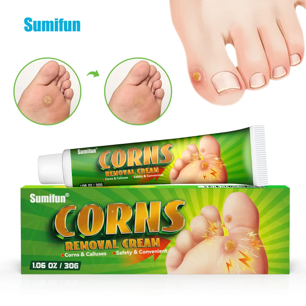 Foot Corn Remover Cream Chicken Eye Skin Infection Treatment Ointment Feet Dead Skin Calluses Removal Tool Health Care 내성발톱