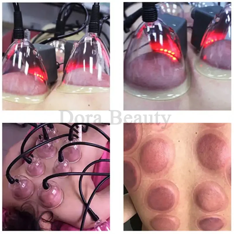 Professional Breast Enhancer Butt Lift Buttock Vacuum Lifting Breast Enlargement Cupping Gua Sha Therapy Body Massage Machines