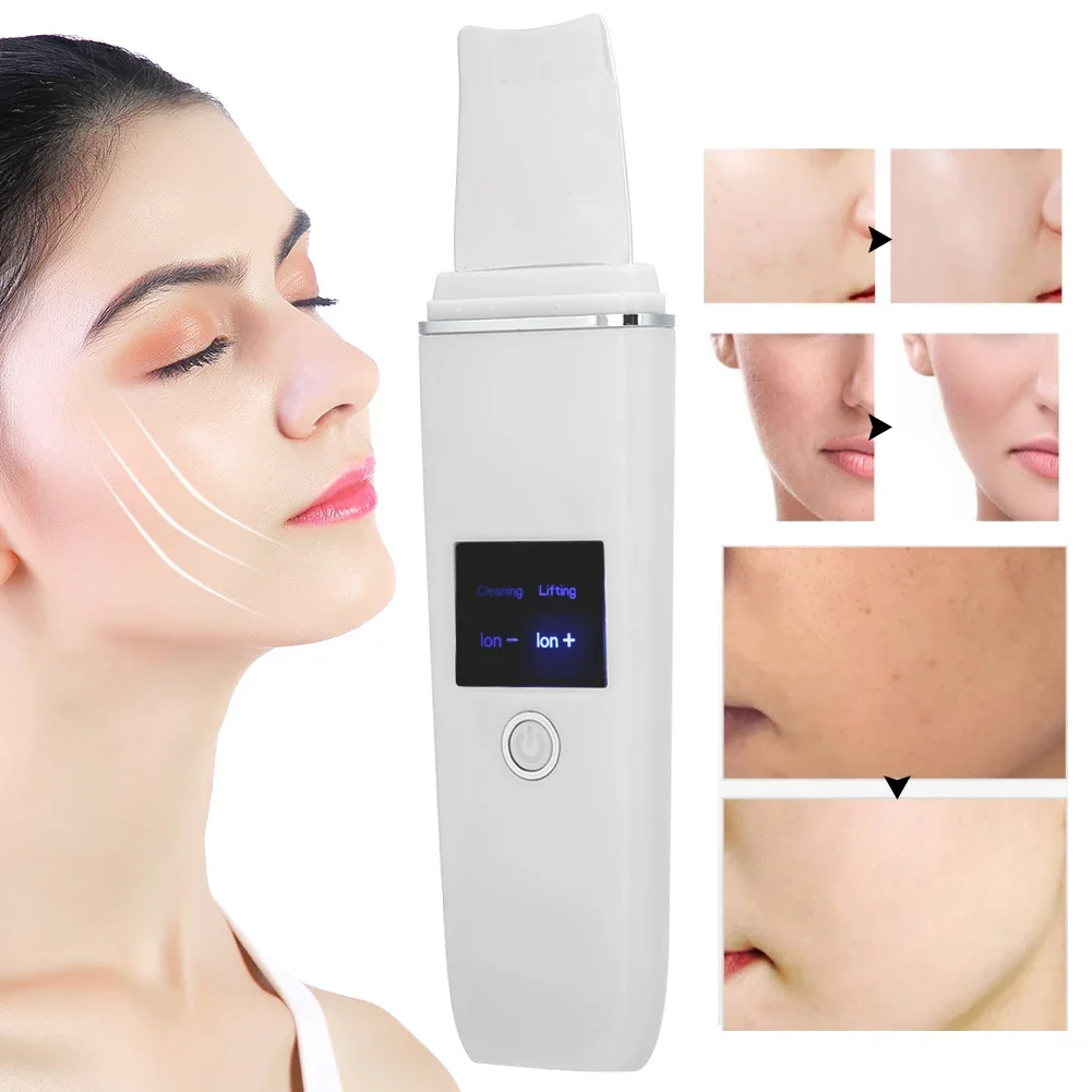 Draagbare Gezicht Huid Scrubber Reiniging Gezicht Peeling Machine Mee-eter Remover Gezicht Reiniging Ultrasone Exfoliërende Huidverzorging