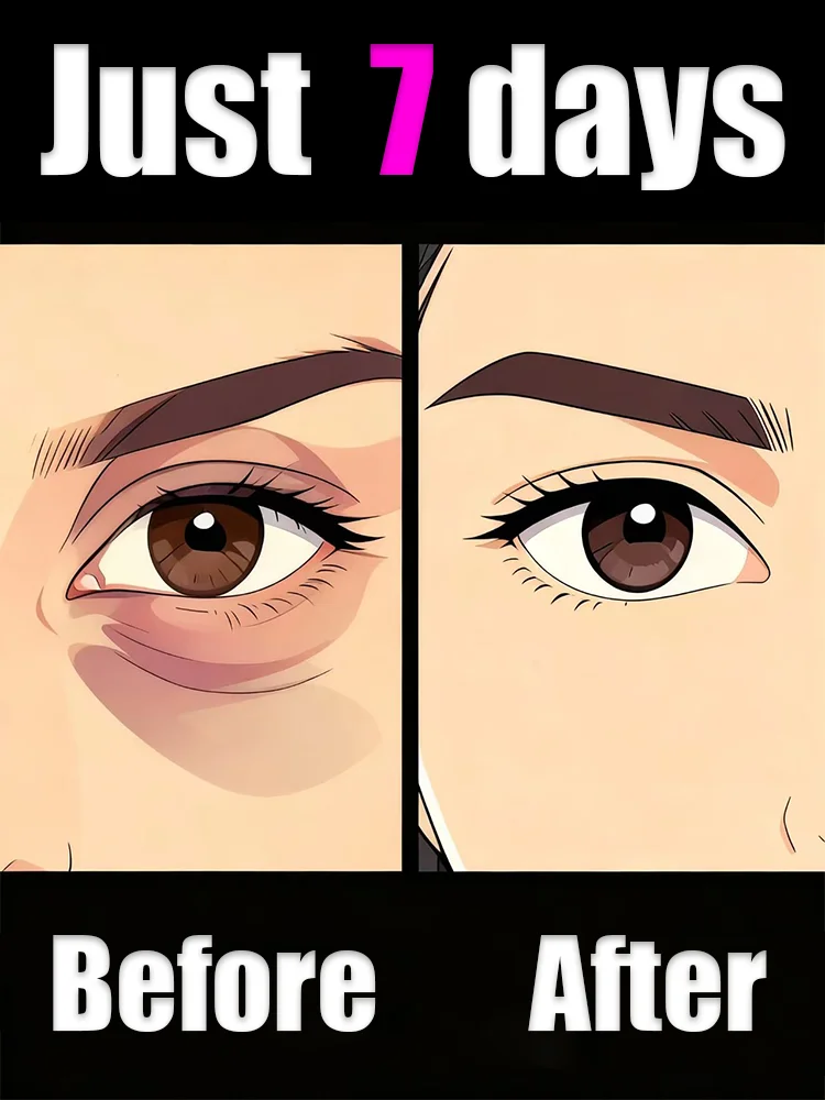 

Eye tools to improve periorbital fat and remove blemishes in seven days