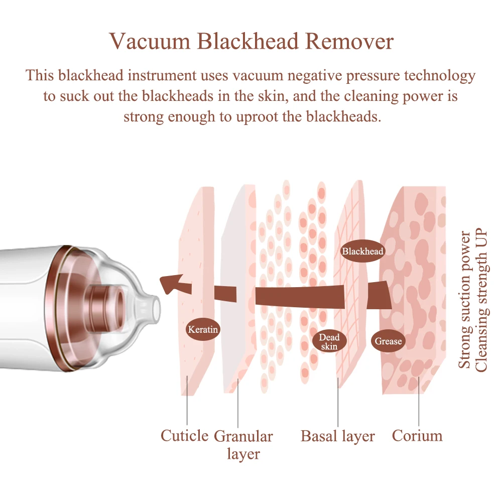 전기 충전식 블랙헤드 리무버, 교체 가능한 흡입 헤드, 진공 블랙헤드 리무버 도구 키트, 6 개