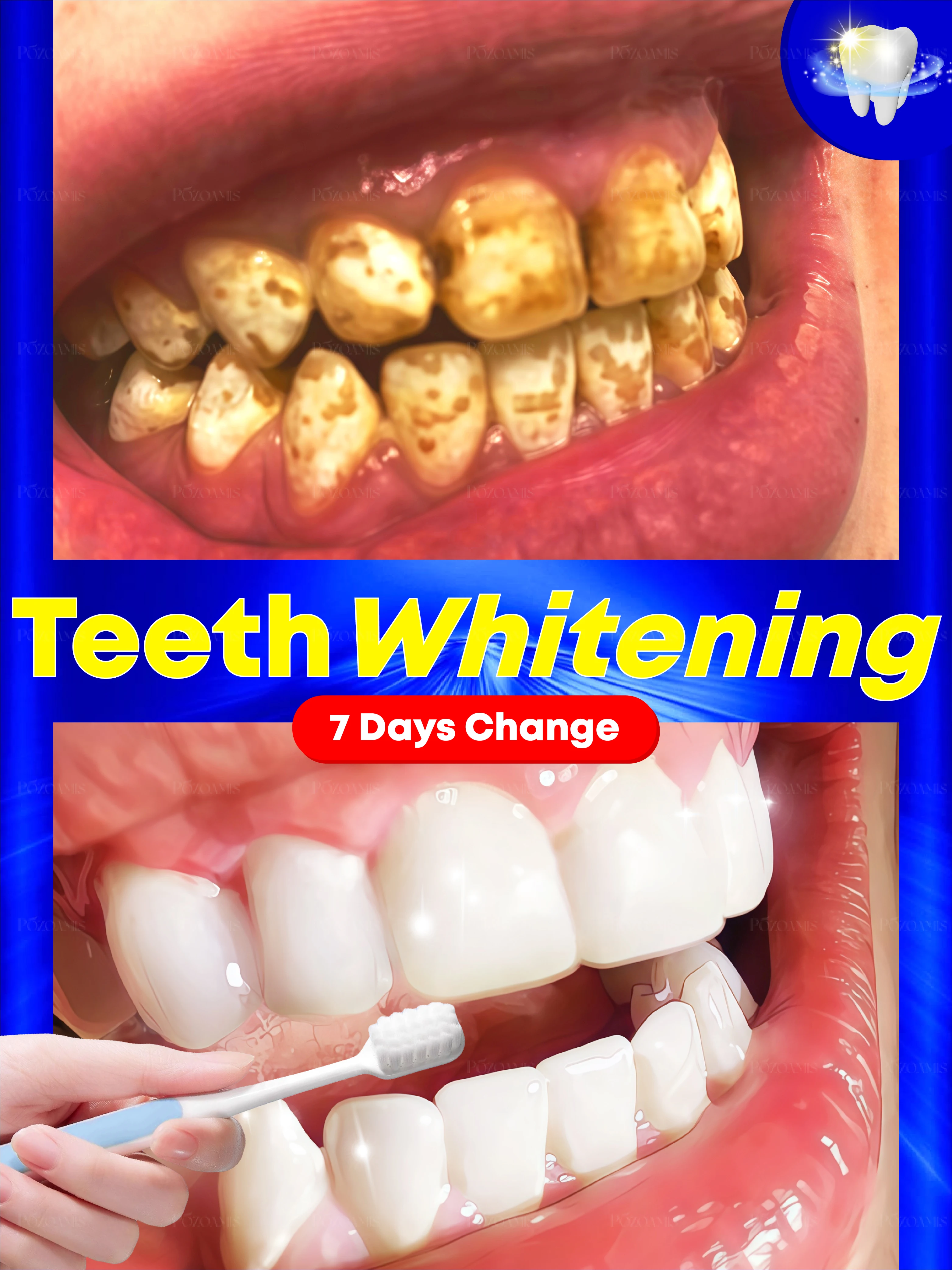 

New technology to bleach cleaner teeth effectively oral problems