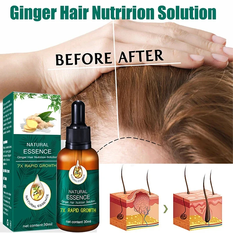 Hair Rapid Growth Care Essential Oil Product Essence Tough Hair Regeneration Care Natural Ginger Anti Hair Loss Series New