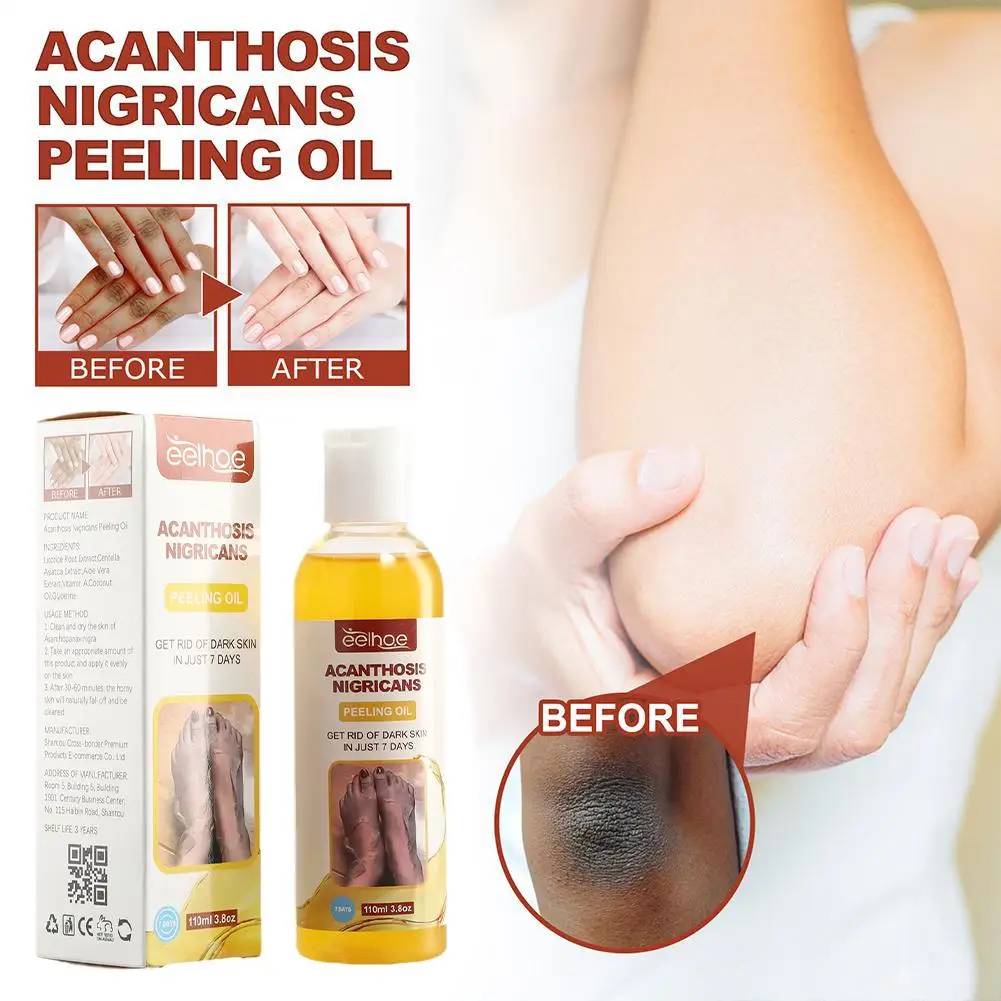 

Yellow Peeling Oil Dark Skin Bleaching Lighten Elbows Remove Arm Knee Legs Body Even Skin Tone Whiten Skin Care Serum