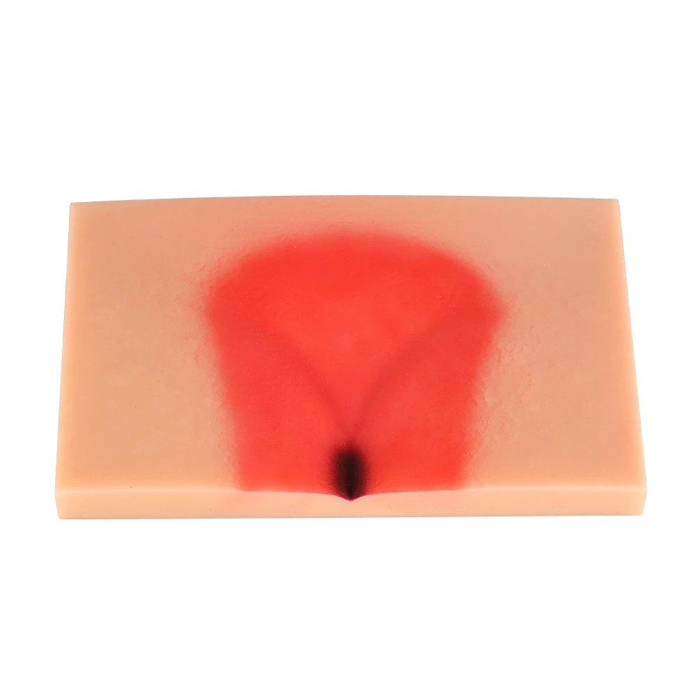 زخم ضغط السيليكون (المرحلة 1-4) نموذج تمريض مظاهرة، محاكي السيليكون، نموذج للتدريس