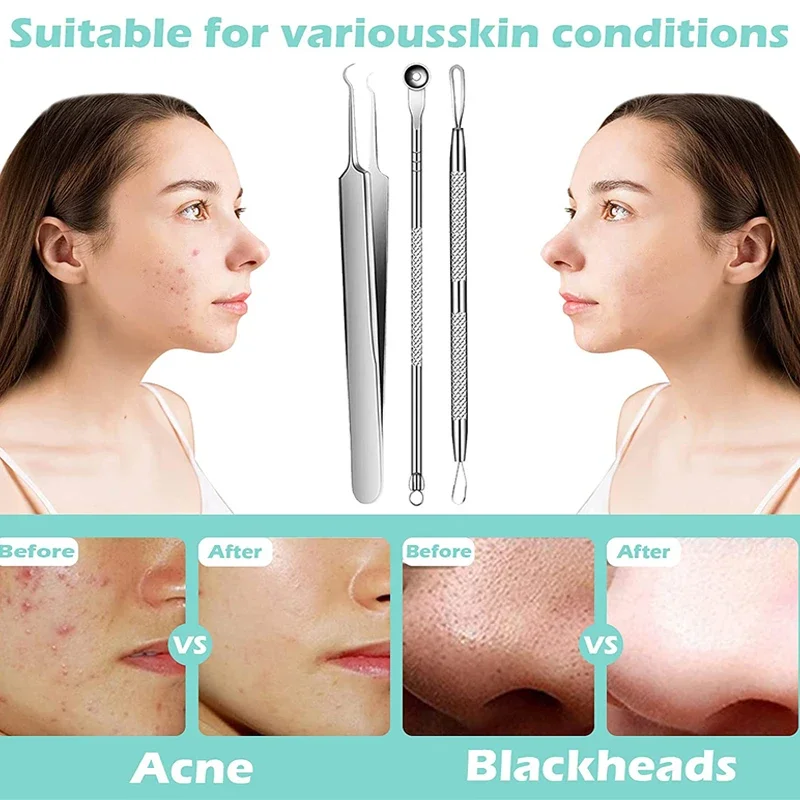Thumbnail 2 - #29 Latest Skin Care Extractors Offers