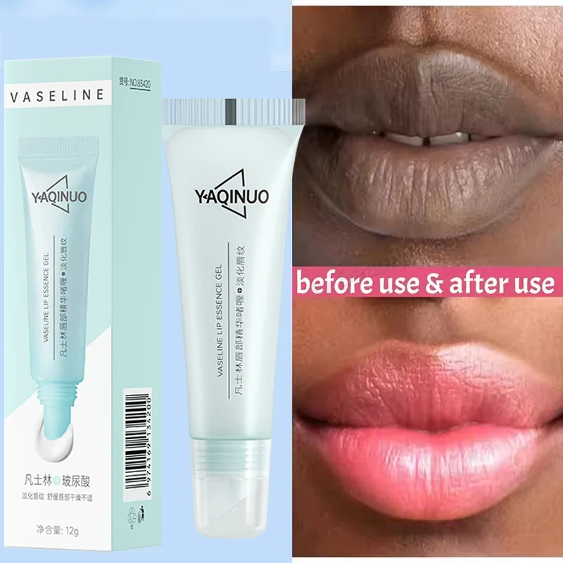 Remove Dark Lip Balm Fast Lightening Pink Lip Exfoliating Fade Lip Line Dead Skin Moisturizer Korean Care Products Beauty Health