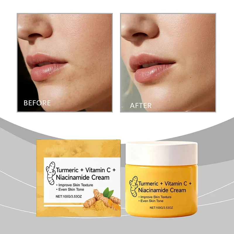 

Niacinamide Face Cream Turmeric Extract Reduce Dark Spots Oil Control Long-lasting Moisturizing Smooth Soft Facial Skin Care