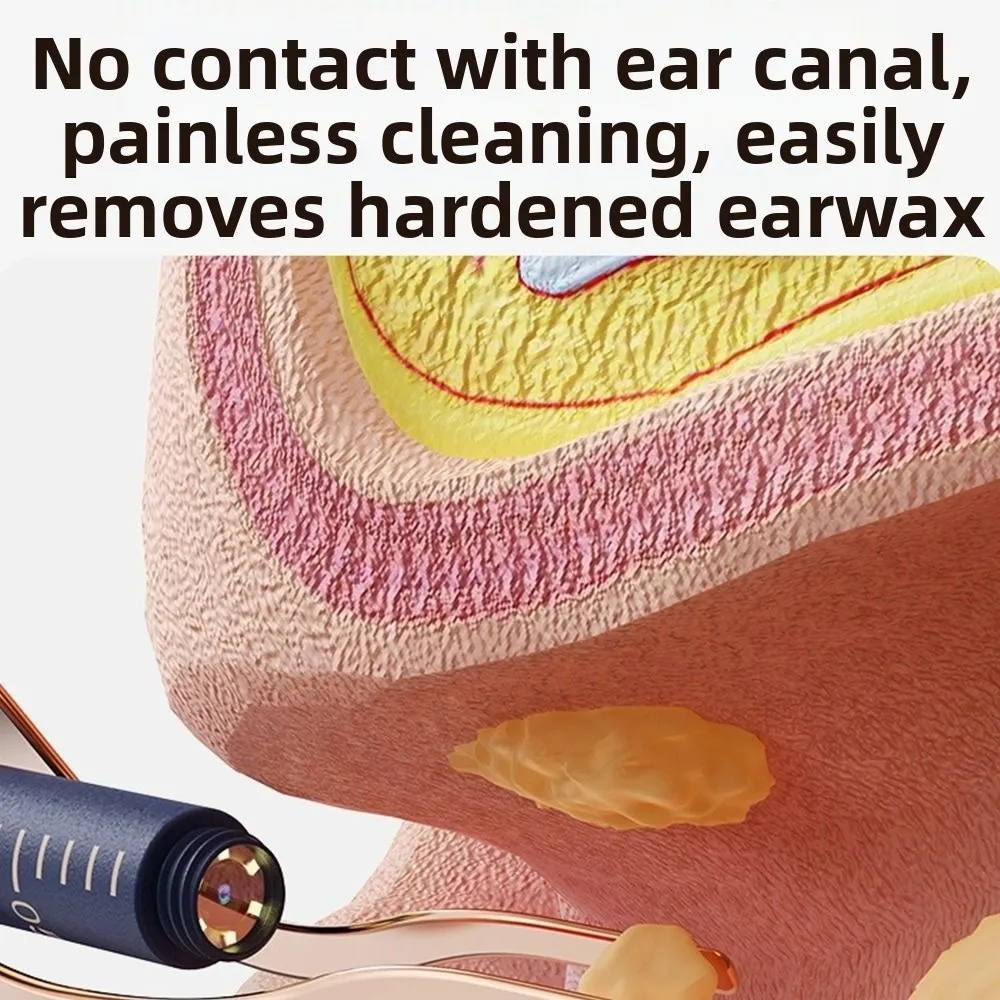 

New EarSight Plus Smart Visual Ear Cleaner 6 LED Lights 1080P Earpicks with tweezer Ear Wax Removal Cleaner Ear Care