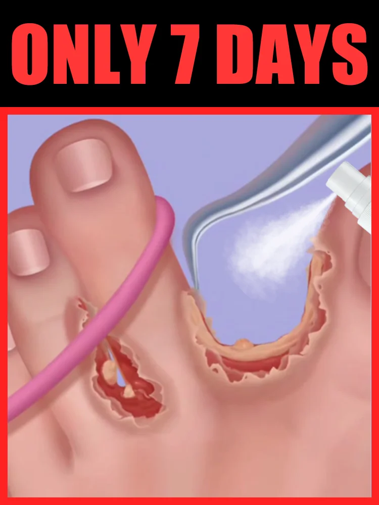 

2026 New Upgrade helping people who stickiness and discomfort solve their problems,foot tools,free shipping,unisex