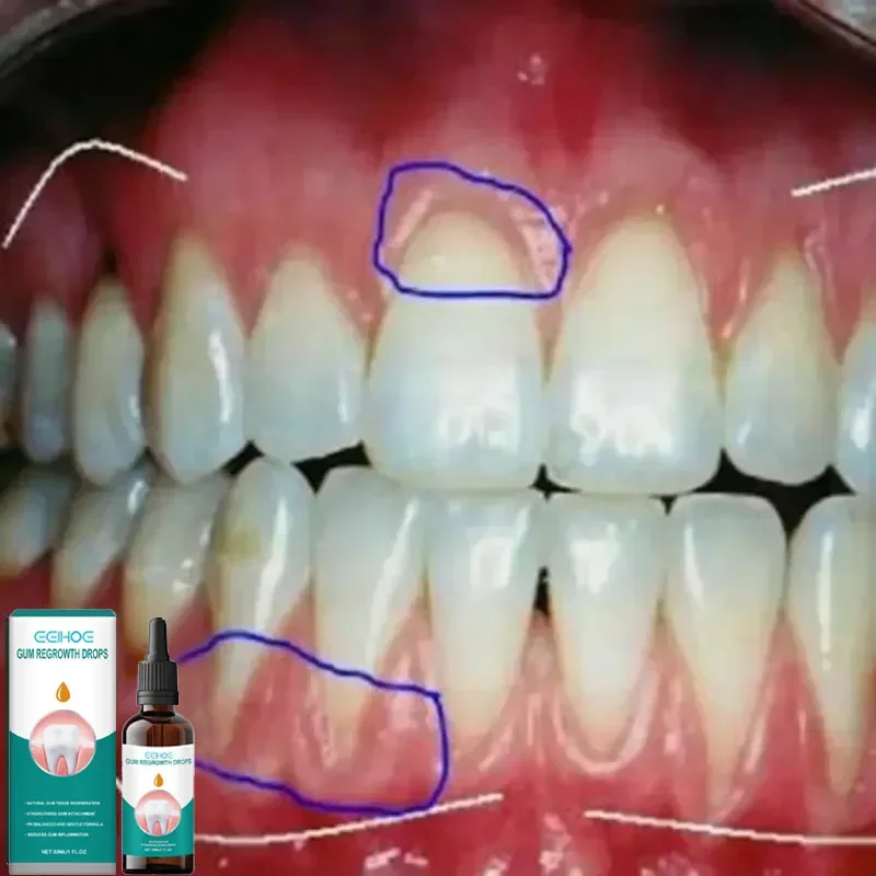 Быстрое восстановление кариеса, мусс для чистки зубов, отбеливание, удаление желтых пятен от зубного налета, снятие кариес, зубная паста