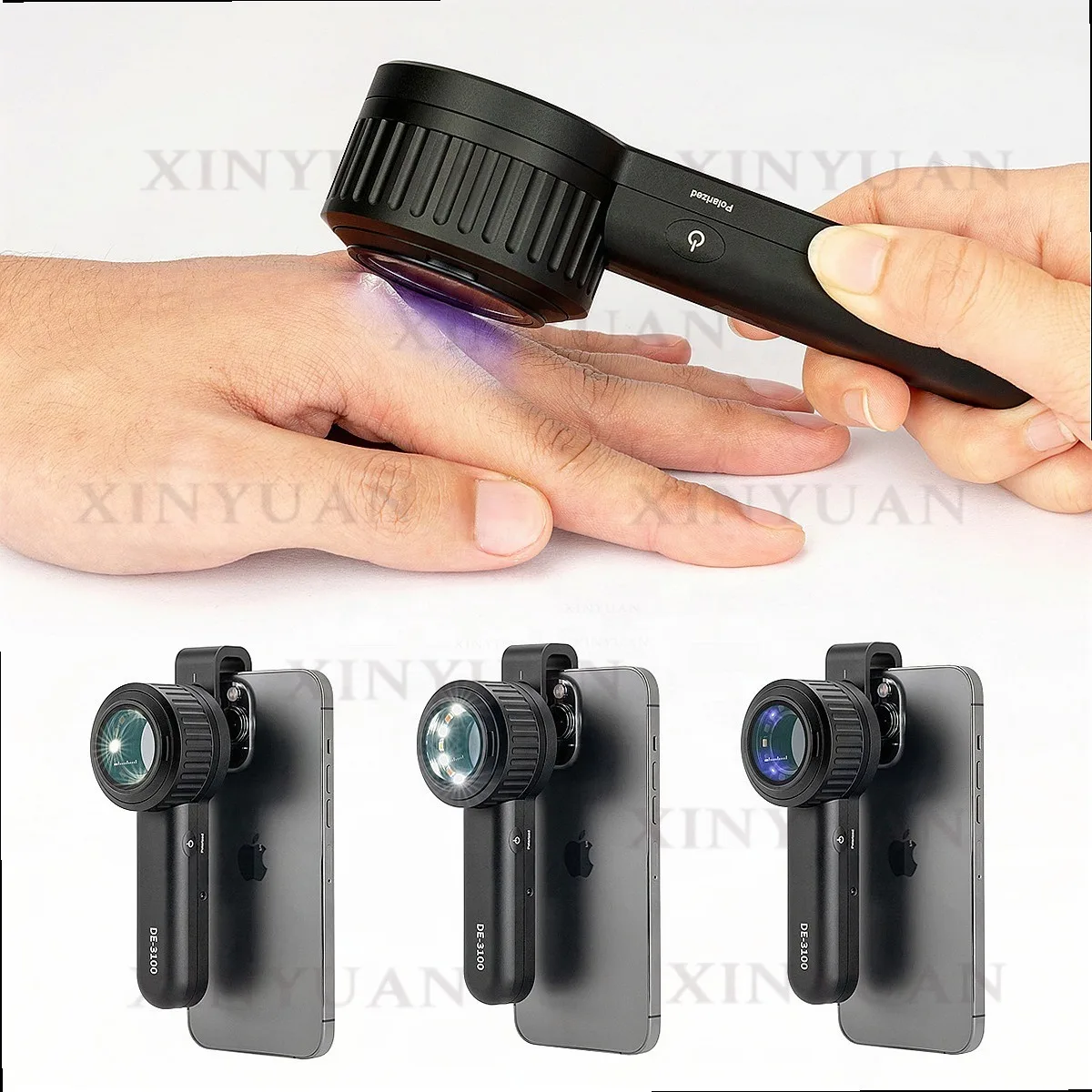 Portable Dermatoscope with 365nm UV Light for Melanoma Prevention IBOOLO DE3100 Pro