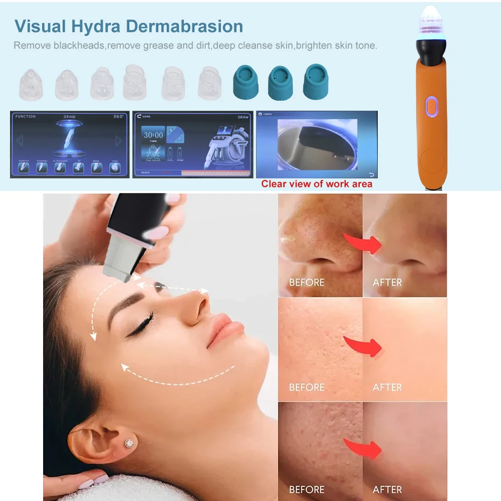 New Water Oxygen Dermabrasion Faci Machine Skin Tightening Rejuvenation Face Lifting Skin Beauty Cleansing Bubble Equipment