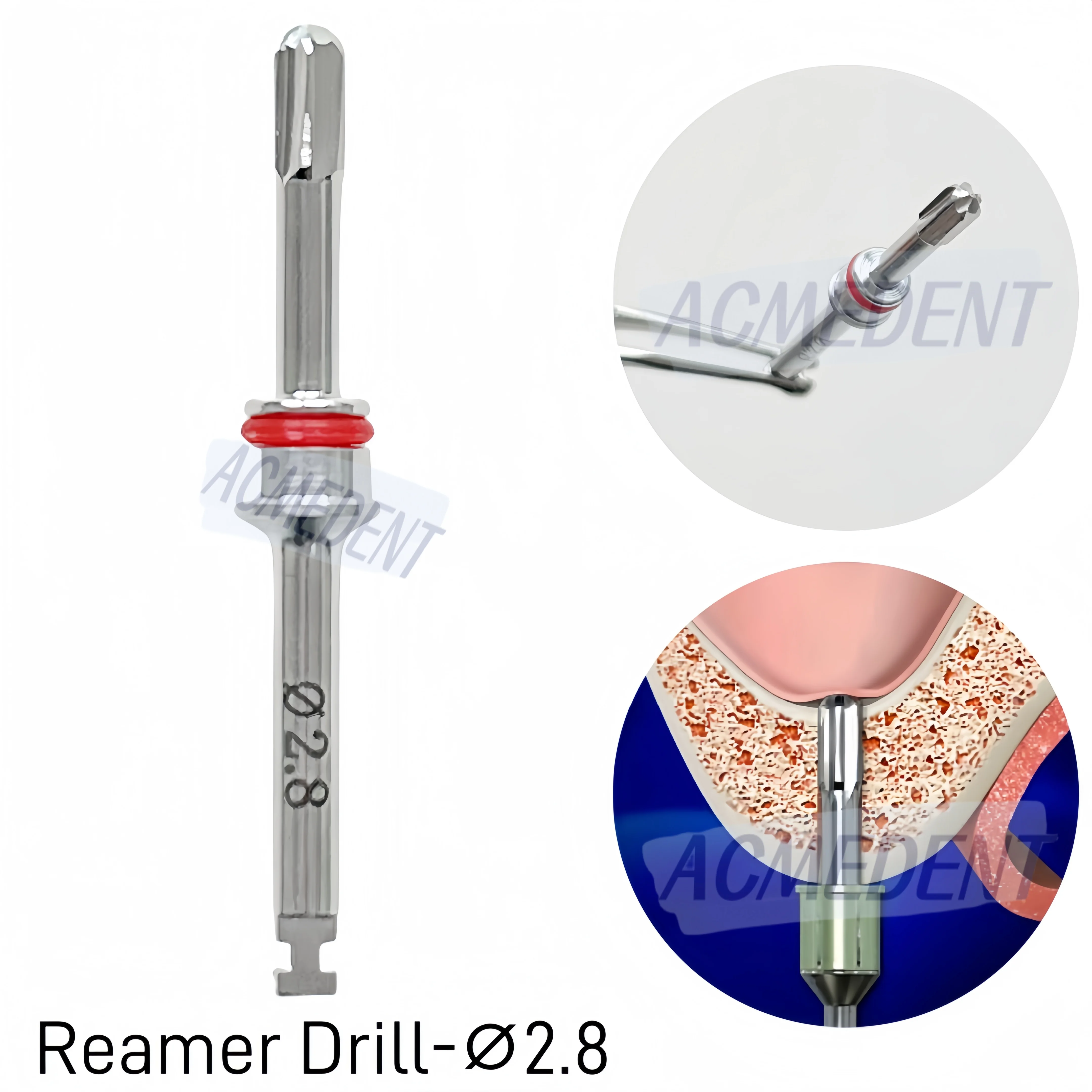 ⌀2.8 Dental Round Reamer Drill Crestal Approach Sinus Lifter Membrane Safe Perforate Sinus Interior Wall 1-10pcs