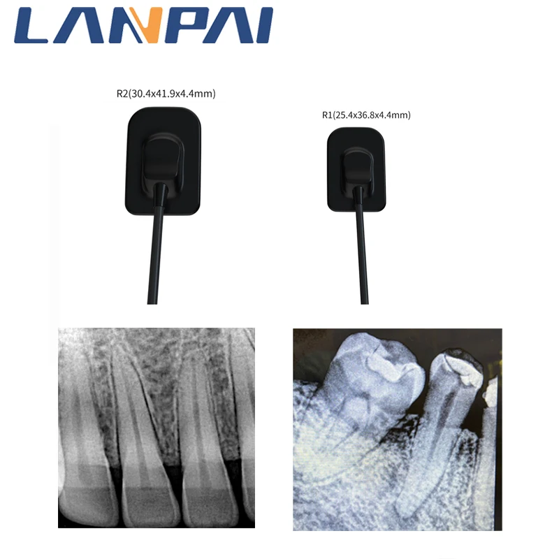 

Lanpai Dental X-ray Sensor Radiovisiograph RVG Intraoral Portable Rx Digital System for dentistry With 13 Language