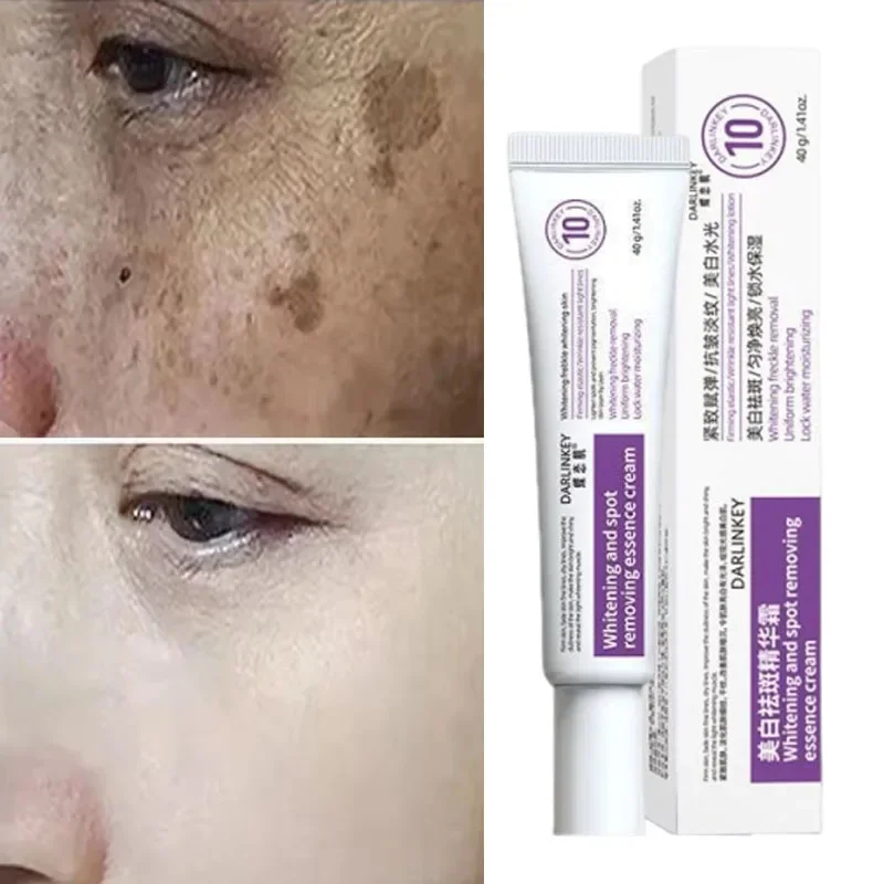 

Powerful Spot-removing Whiten Cream Brighten Skin Fast Eliminates Melanin Pigmentation Melasma Dark Spots Moisturize Beauty Gel