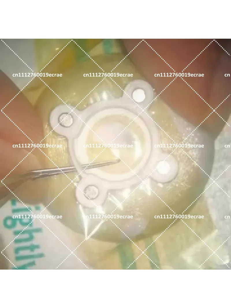 Ophthalmology Phacoemulsification Capsulorhexis Forceps Circular Capsule Operation Practice Model with 1/2/3M Film