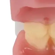 

Новая стоматологическая модель для взрослых, смола, нормальная стоматология, медицинская модель зубов, обучение, образование, оральные стоматологические товары