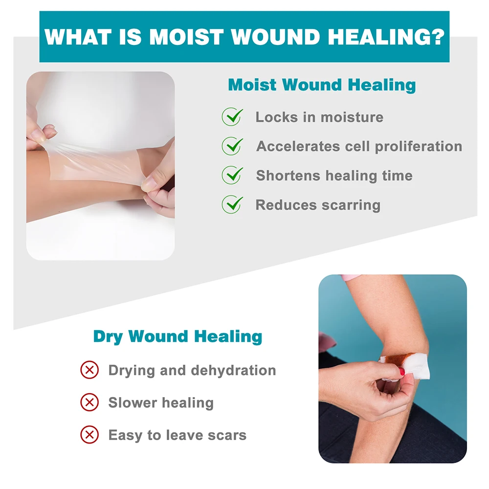 Hydrocolloid Roll Self-Adhesive Hydrocolloid Patch Bandage For Wound Care Bed Sore Bandages Hydrocolloid Gel Waterproof Patches view 3