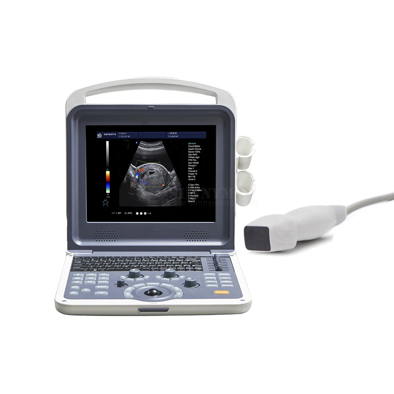 SY-A042-1 me dical Color Doppler Ultrasound Diagnostic System Ultrasound Instruments Ultrasound Scanner