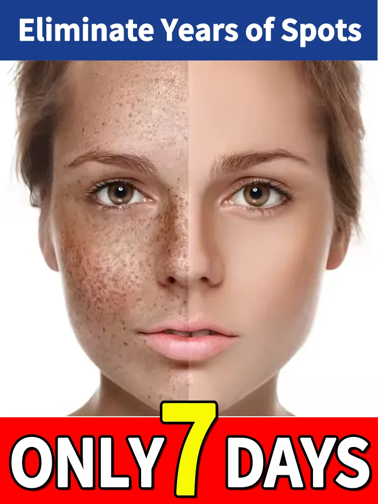 ลบฝ้าบนใบหน้าเพียง 7 วัน