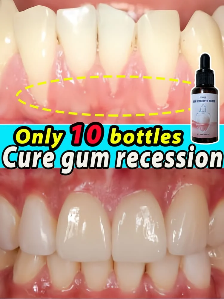 Repair damaged gums relieve gum pain, strengthen gums and restore healthy gums