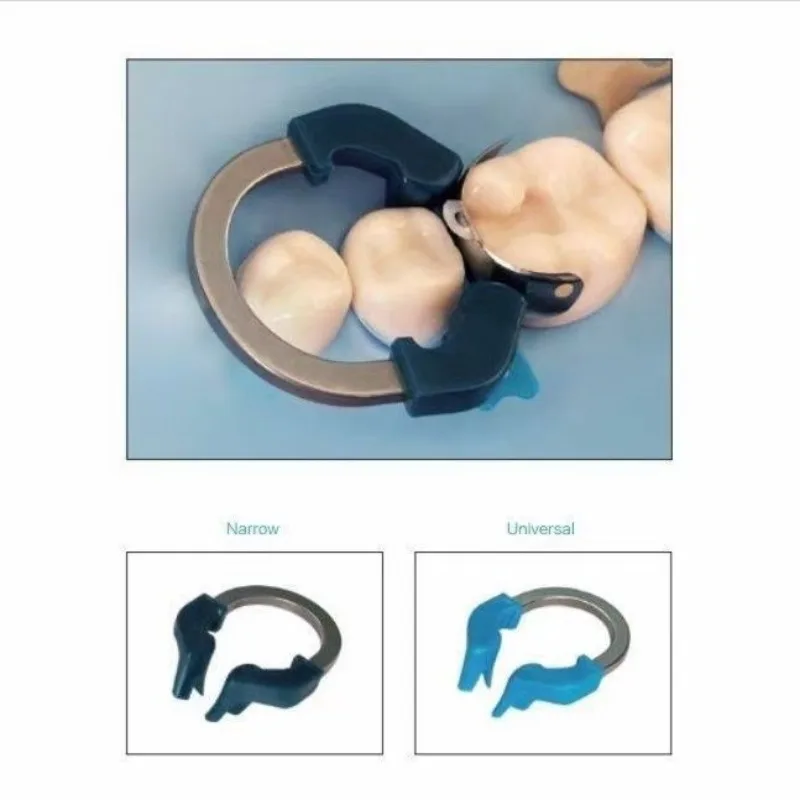 Material dental formando anel de braçadeira de titânio de níquel separado dente formando braçadeira dentadura separação correspondência fixação moldada ferramentas