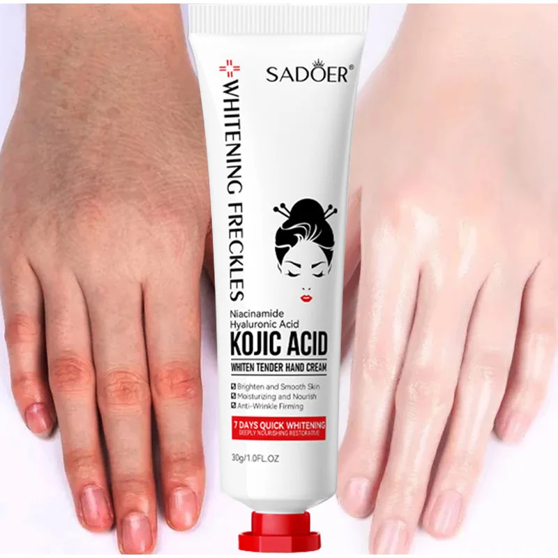 Kojic Acid Whiten Hand Cream Fast Smooth Nourish Cream Moisturize Anti-wrinkle Anti-drying Lighten Cracked Repair Care Product