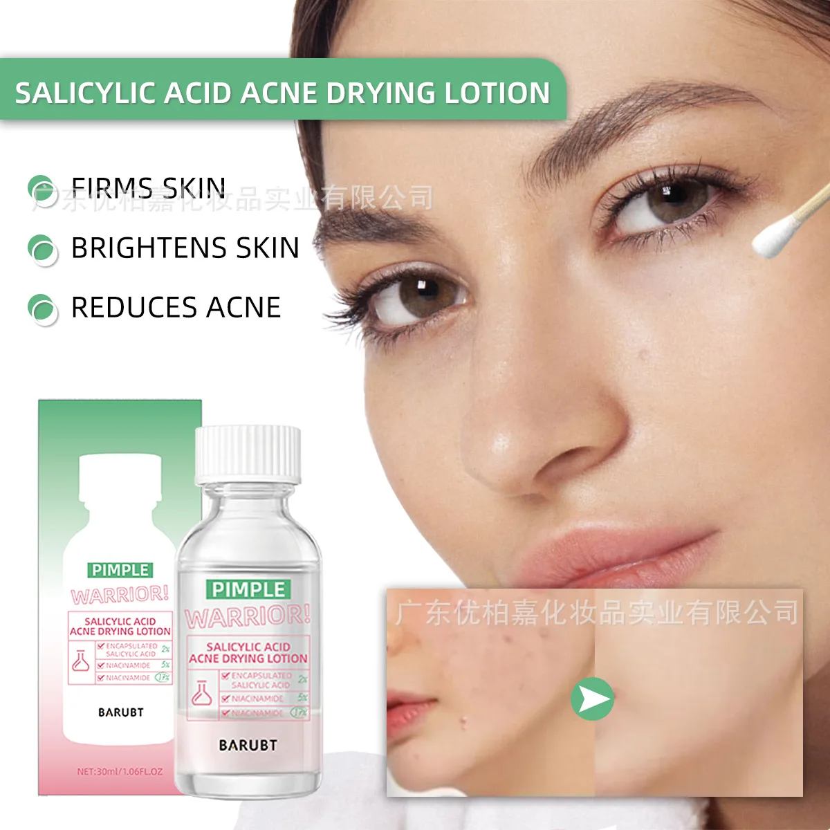 Niacinamide Salicylic Acid Acne Serum Quick Acne Removal Light Red Gentle Repair