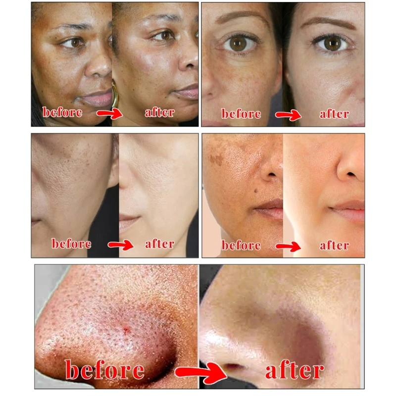 мыло с койевой кислотой и витамином С, гиалуроновая кислота, кокосовое масло, глубокое очищение, мягкое мыло для лица, масло для