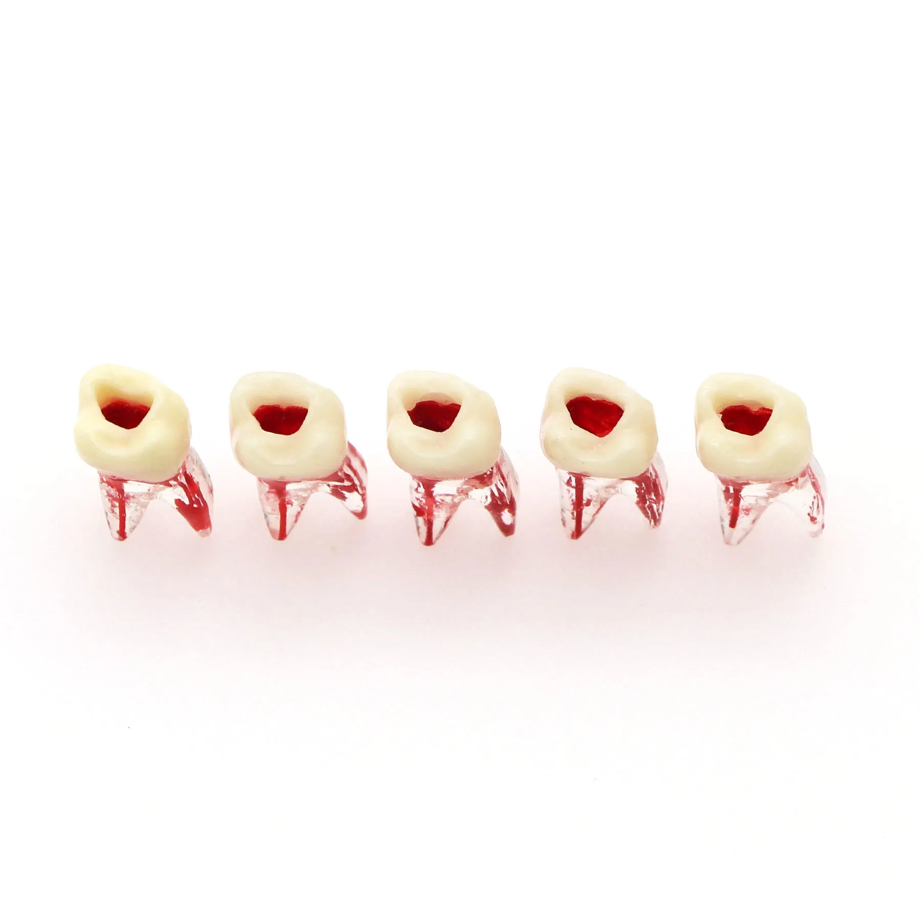 Clear Resin Root Canal Training Teeth Model Endodontic Practice Tooth With Visible Red Pulp Dental Student Root Therapy Model