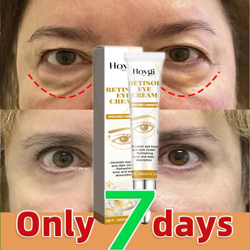 

Instant Eye Bag Removal Cream Retinol Anti-Wrinkle Fade Fine Lines Firming Skin Anti Dark Circle Puffiness Brighten Eye Care ﻿