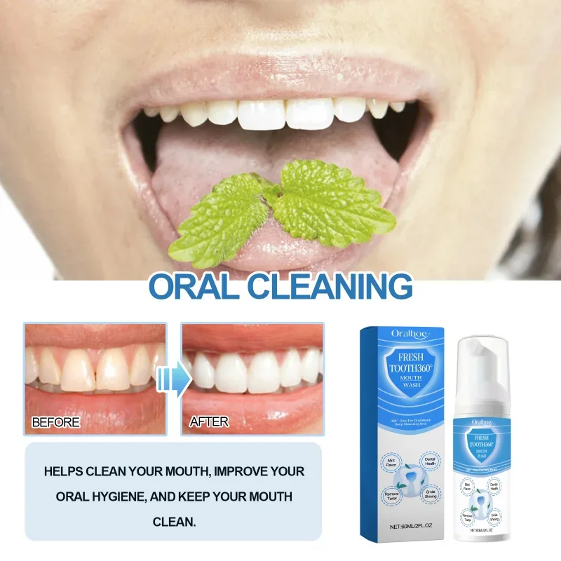 

Oral Cleaning Mousse for Reducing Bad Breath Stains & Yellow Teeth Brightening Teeth Supporting Gum Care Daily Oral Hygiene