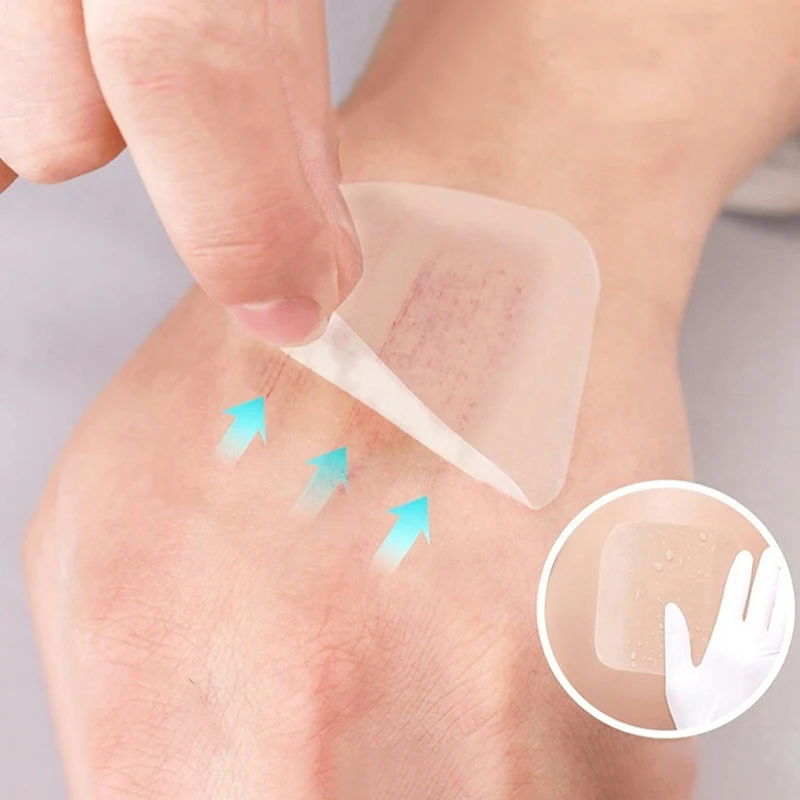 

1 шт. ультратонкие гидроколлоидные пластыри для ран, клейкие, дышащие, водонепроницаемые, прозрачные, способствующие заживлению ран