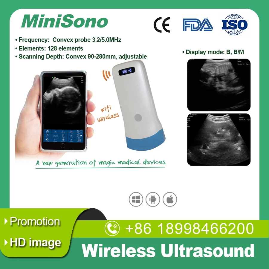 

Wireless ultrasound transducer, black and white convex, 128E, for Android, Windows