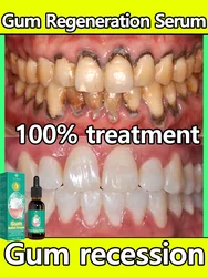 Restore gums