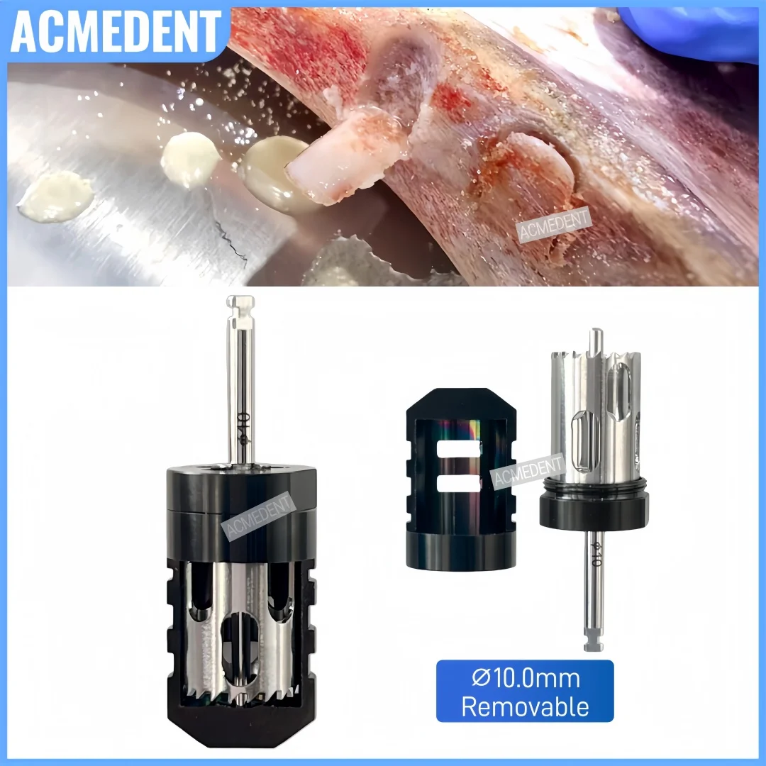 ⌀10.0mm Dental SLT Half Moon Bone Removal Drill Semilunar Technique Trephine Bone Collector Harvest Drill Bone Slice Flake Bone