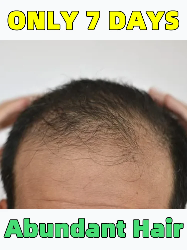 

Аппликатор, массажер для кожи головы, подходит для сборки роста волос, жидкая направляющая расческа, массажный инструмент, горячая распродажа, бесплатная доставка