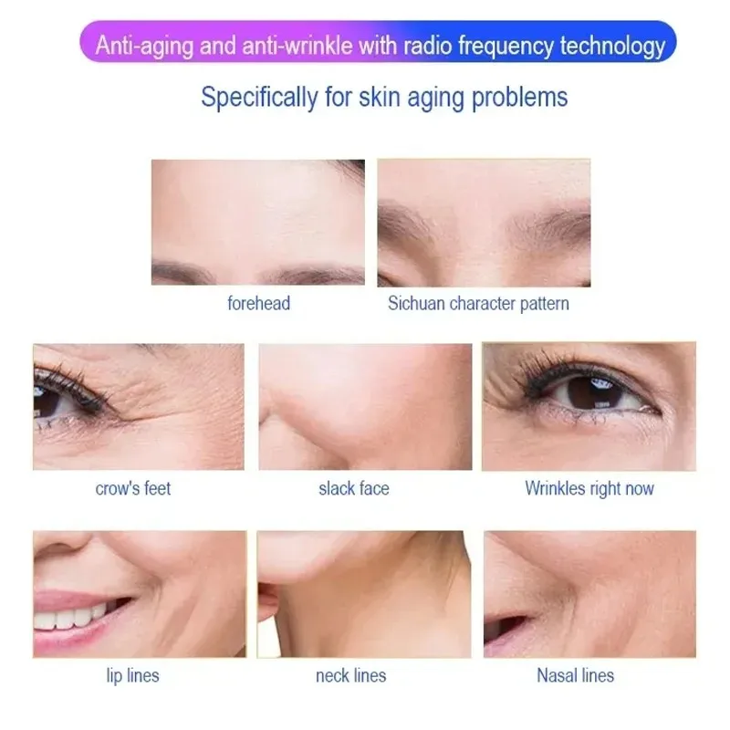 أحدث الترا 360 الدهون الموقد الدهون مزيل الوجه رفع الجلد تشديد التخسيس الجسم الكنتوري السيلوليت المهنية