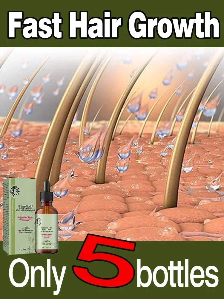 

Hair Growth Essential Oil Pure Natural Rosemary Mint Hair Strengthening Oil Nourishing Treatment for Split Ends Dry Mielle