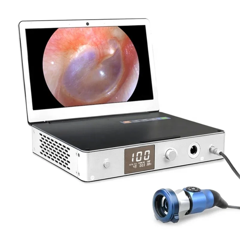 

ALL IN ONE 12 Inches Screen Hd Portable Ent Endoscope With Led Light Source and HD Medical For