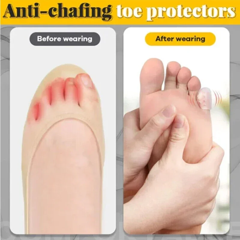 Protector de tubo para dedos para pies, mangas transpirables para aliviar el dolor por fricción, Gel de silicona, herramienta para el cuidado de los pies, protección para los dedos, 10 Uds.