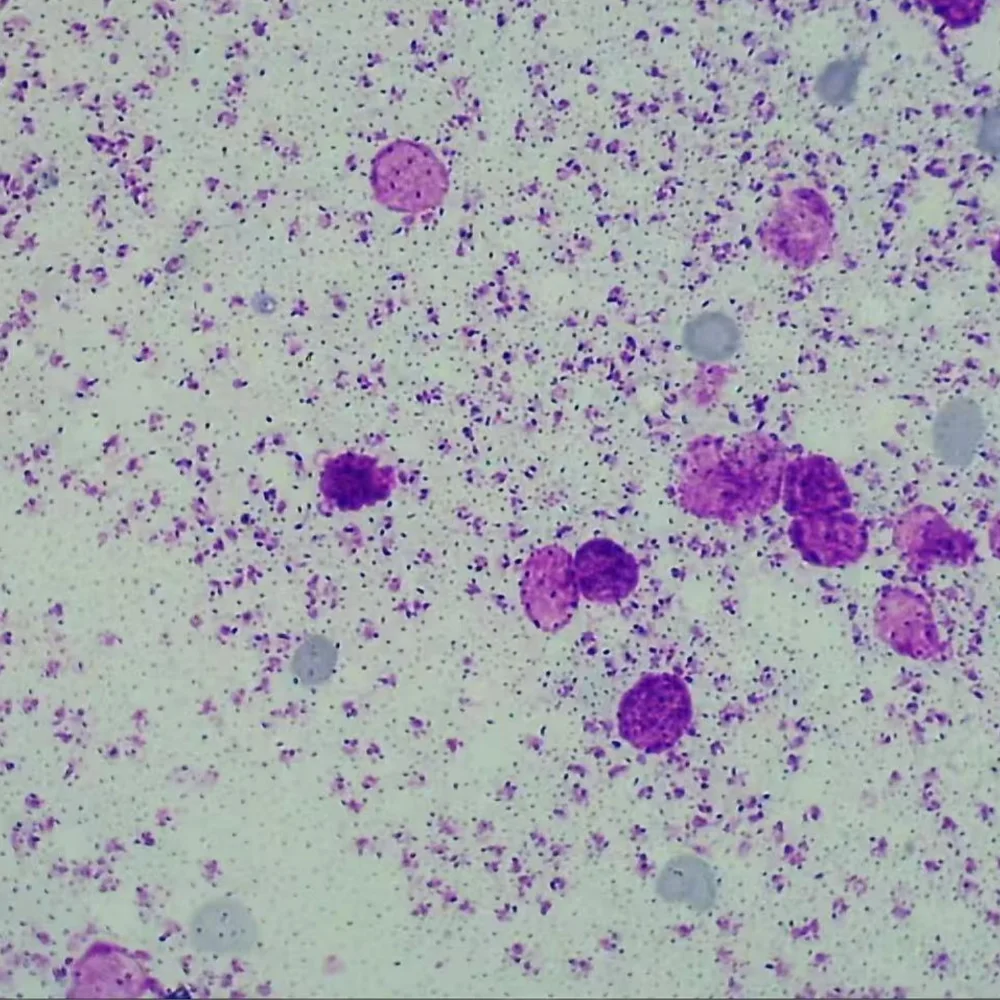 

1 шт., крепление Whloe Leishmania Donovani Amastigote W.M, подготовленные предметные стекла для микроскопа