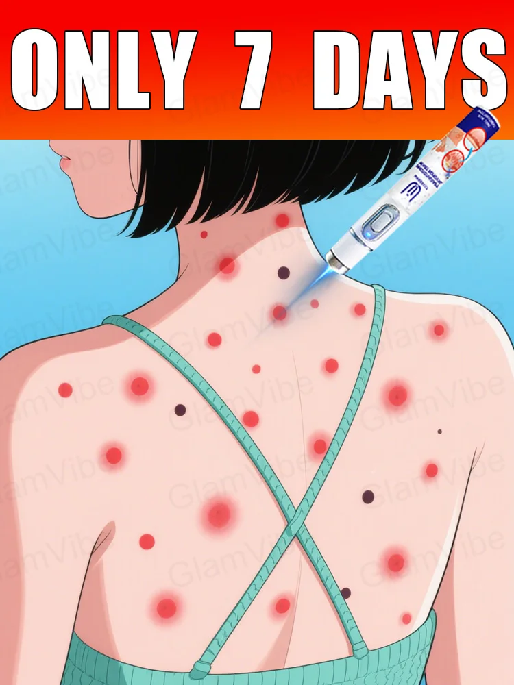 

blue light pen solve warts, hot sale wart care tools