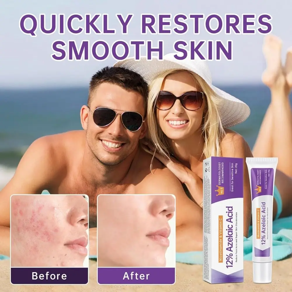 Azelaic Acid 12% 20% Serum Azelaic Acid Cream Nicotinamide Serum Reduces Acne and Pimples Azelaic Acid 12% Serum Cream
