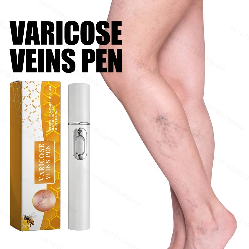 Lampshade Therapy Varicose Veins Effective Relief of Dilated Vasculitis In The Legs Phlebitis Health Improved Blood Circulation