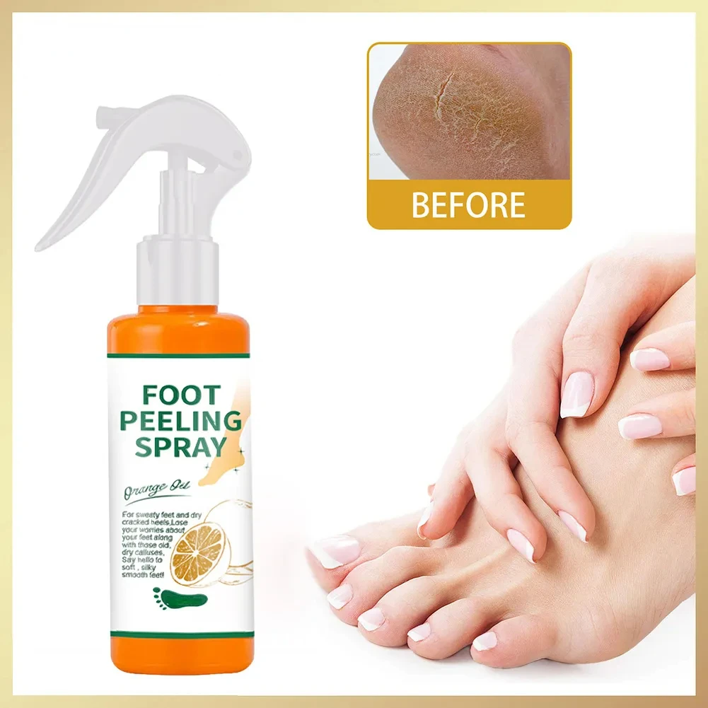 100ml Foot Peeling Spray Orange Essential Oil Exfoliating Nourish Peel Feet Calluses Dead Skin Remover Pedicure Foot Care Tool